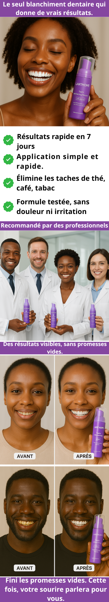 Mousse de blanchiment des dents Lanthome sg