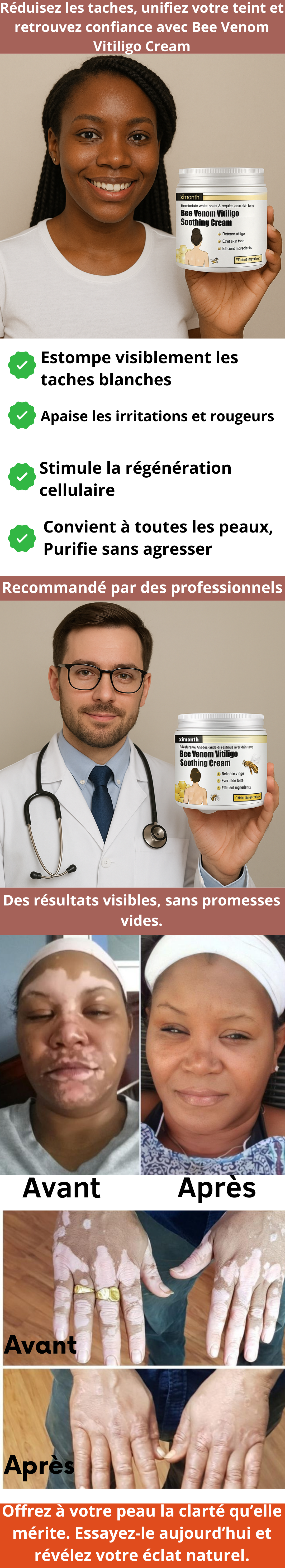 Crème au venin d'abeille – La solution douce pour estomper les taches blanches