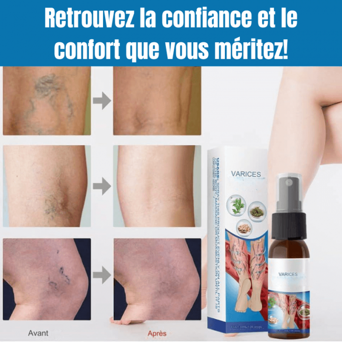 Spray anti Varices