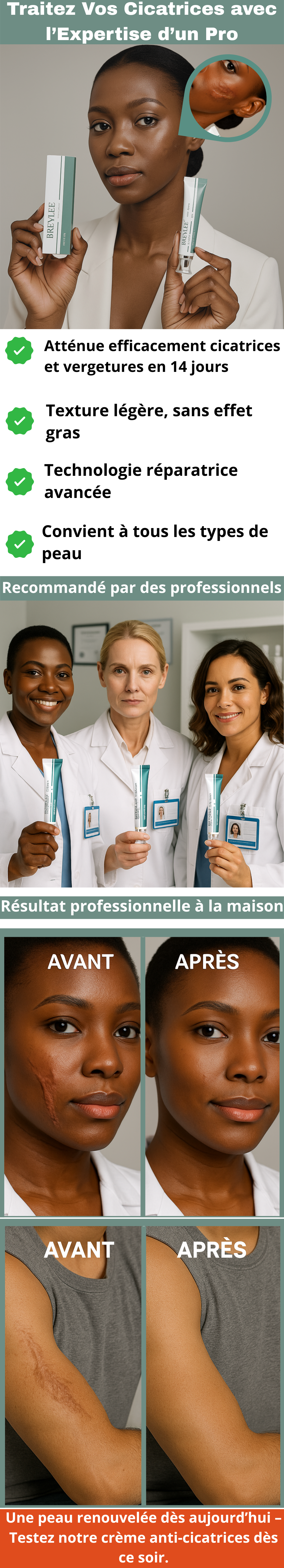 Cream anti-vergetures et anti-cicatrice